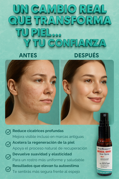 SPRAY PARA CICATRICES 30ML